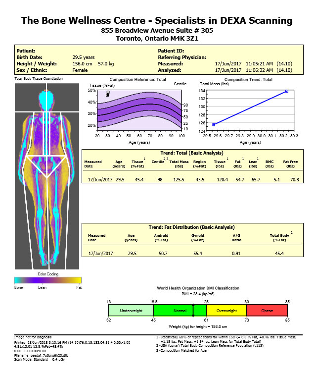 dexa-scan-toronto-body-composition-fat-scan-near-gta