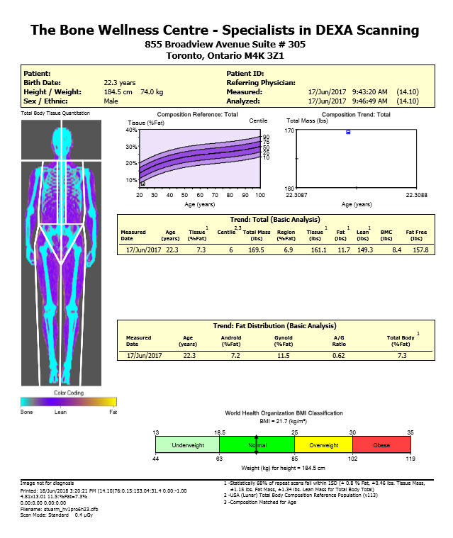 Dexa Male Competitive Scan